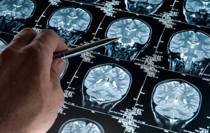 Un software de desarrollo argentino podría diagnosticar de forma precoz el Alzheimer