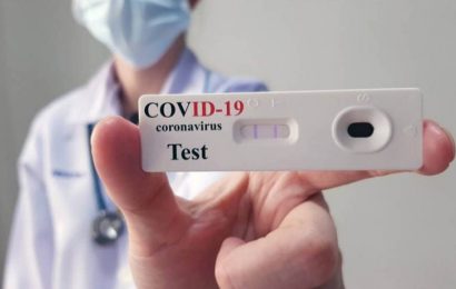 Los primeros autotest estarían disponibles la próxima semana en farmacias, a 1.560 pesos